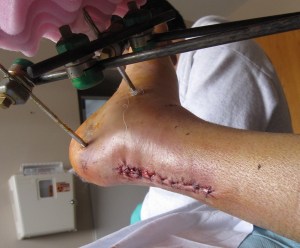 kc - stitched IMG_2030(LR)