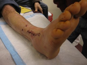 kc - frankenfoot 2040(LR)